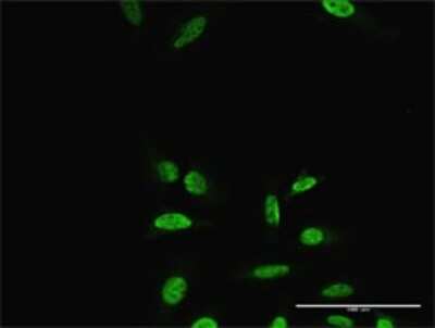 Immunocytochemistry/ Immunofluorescence: PRRX2 Antibody [H00051450-D01P]