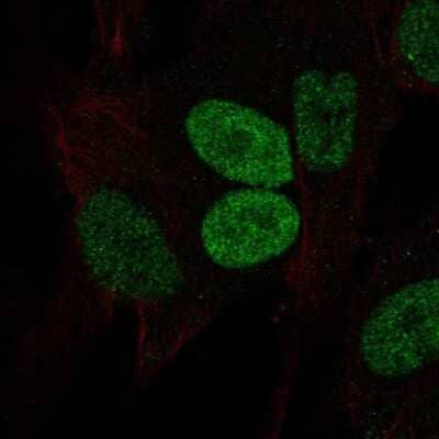 Immunocytochemistry/ Immunofluorescence: PRRX2 Antibody [NBP2-58891]