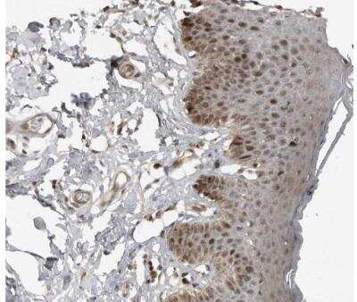 Immunohistochemistry-Paraffin: PRRX2 Antibody [NBP1-80893]