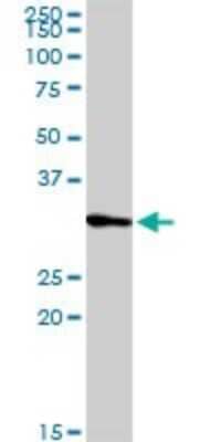 Western Blot: PRRX2 Antibody [H00051450-D01P]