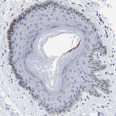 Immunohistochemistry-Paraffin: PRSS16 Antibody [NBP1-90649]