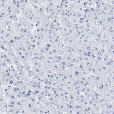 Immunohistochemistry-Paraffin: PRSS16 Antibody [NBP1-90649]