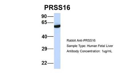 Western Blot: PRSS16 Antibody [NBP1-91559]