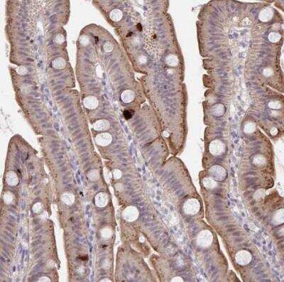 Immunohistochemistry-Paraffin: PRSS33 Antibody [NBP2-34099]