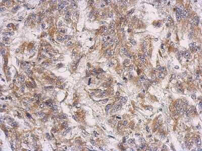 Immunohistochemistry-Paraffin: PRSS35 Antibody [NBP2-19970]