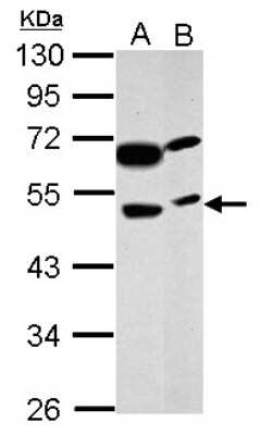 Western Blot: PRSS35 Antibody [NBP2-19970]