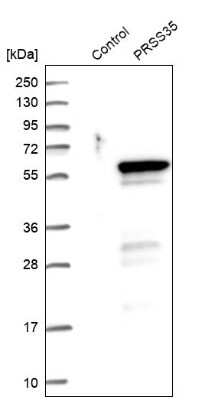 Western Blot: PRSS35 Antibody [NBP2-32646]