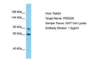 Western Blot: PRSS36 Antibody [NBP2-83425]