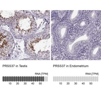 Immunohistochemistry-Paraffin: PRSS37 Antibody [NBP1-86430]