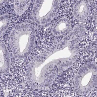 Immunohistochemistry-Paraffin: PRSS37 Antibody [NBP1-86430]