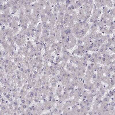 Immunohistochemistry-Paraffin: PRSS37 Antibody [NBP1-86430]