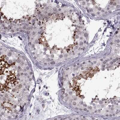 Immunohistochemistry-Paraffin: PRSS37 Antibody [NBP1-86430]