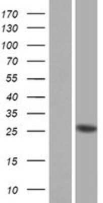 Western Blot: PRSS37 Overexpression Lysate [NBP2-08804]