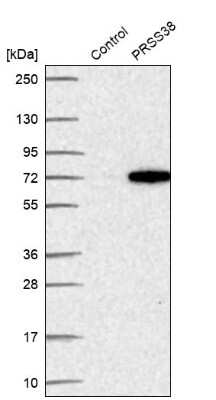 Western Blot: PRSS38 Antibody [NBP2-49193]