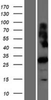 Western Blot: PRSS42 Overexpression Lysate [NBP2-04826]