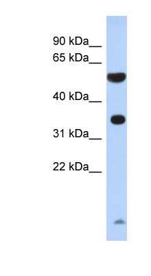 Western Blot: PRSS48 Antibody [NBP1-70689]