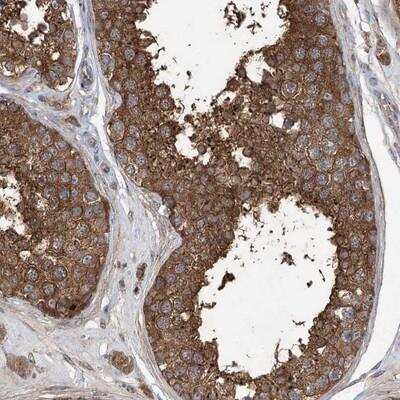 Immunohistochemistry: PRSS53 Antibody [NBP1-90678]