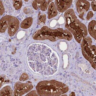 Immunohistochemistry-Paraffin: PRSS53 Antibody [NBP2-48629]