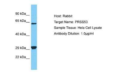 Western Blot: PRSS53 Antibody [NBP2-85548]