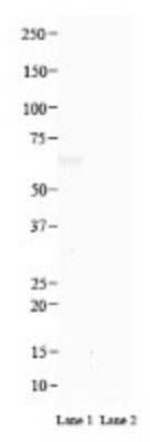 Western Blot: PRSS56 Antibody [NBP3-09694]