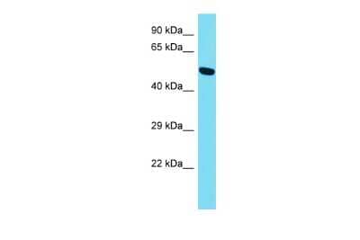 Western Blot: PRSS56 Antibody [NBP3-09695]