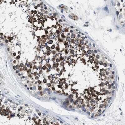 Immunohistochemistry-Paraffin: PRTFDC1 Antibody [NBP1-83261]
