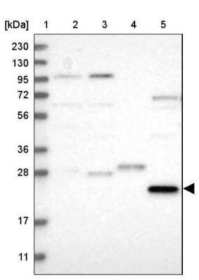 Western Blot: PRTFDC1 Antibody [NBP1-83261]