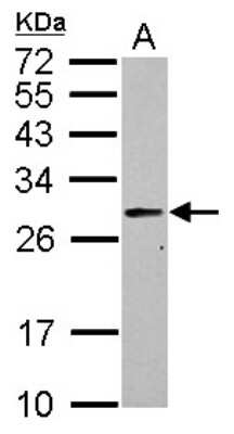 Western Blot: PRTFDC1 Antibody [NBP2-19972]