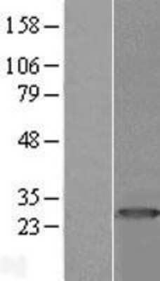 Western Blot: PRTFDC1 Overexpression Lysate [NBL1-14849]