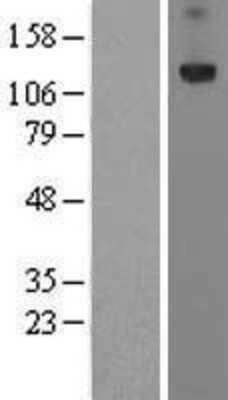 Western Blot: Protogenin Overexpression Lysate [NBL1-14850]