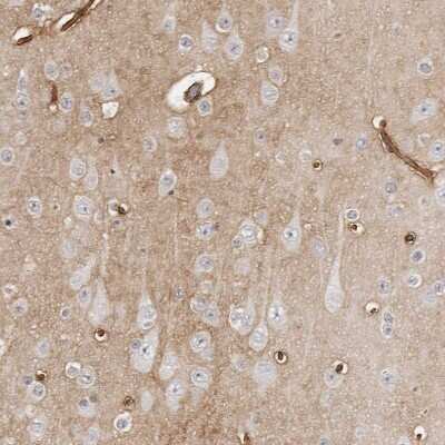 Immunohistochemistry-Paraffin: PRUNE Antibody [NBP1-84055]