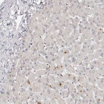 Immunohistochemistry-Paraffin: PRUNE Antibody [NBP1-84055]