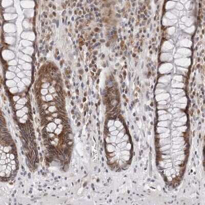 Immunohistochemistry-Paraffin: PRUNE Antibody [NBP1-84055]