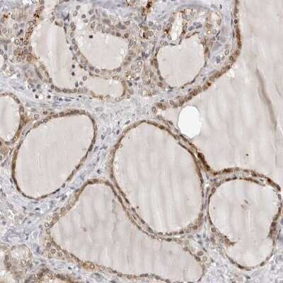 Immunohistochemistry-Paraffin: PRUNE Antibody [NBP1-84055]