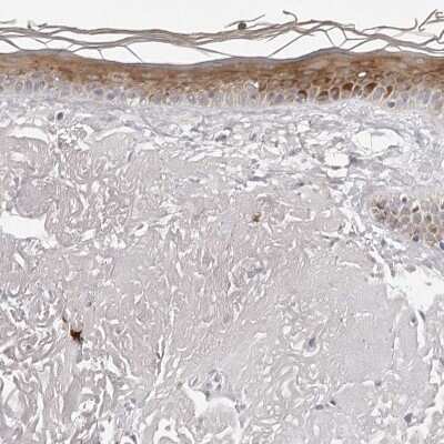 Immunohistochemistry-Paraffin: PRUNE Antibody [NBP1-84055]