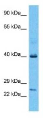 Western Blot: PRUNE Antibody [NBP3-09948]