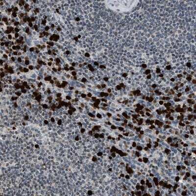 Immunohistochemistry-Paraffin: PRUNE2 Antibody [NBP1-89336]
