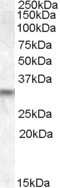 Western Blot: PRUNE2 Antibody [NB100-93446]