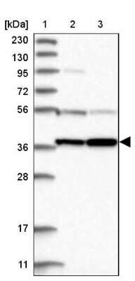 Western Blot: PRUNE2 Antibody [NBP1-89335]