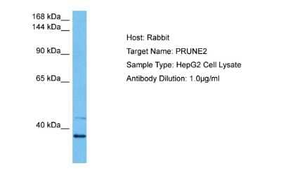 Western Blot: PRUNE2 Antibody [NBP2-88097]