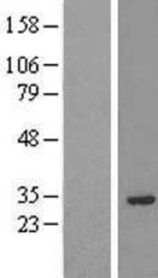 Western Blot: PRUNE2 Overexpression Lysate [NBL1-14853]