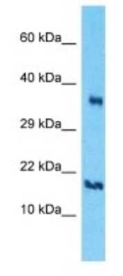 Western Blot: PRY Antibody [NBP3-09513]