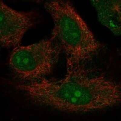 Immunocytochemistry/ Immunofluorescence: PRY2 Antibody [NBP3-17614]