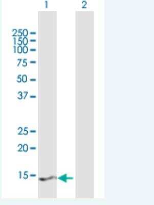 Western Blot: PRY2 Antibody [H00442862-B01P-50ug]