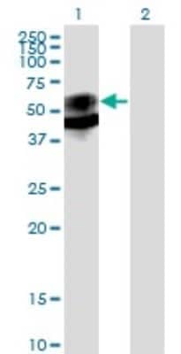 Western Blot: PSAP Antibody (1D1-C12) [H00005660-M01]