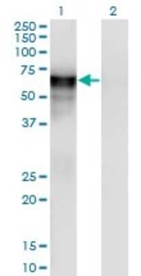 Western Blot: PSAP Antibody (2F6) [H00005660-M03]