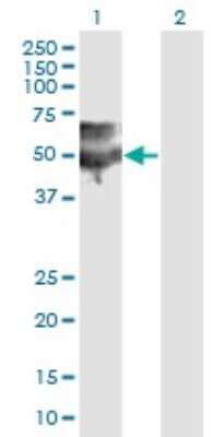 Western Blot: PSAP Antibody (3B12) [H00005660-M11]