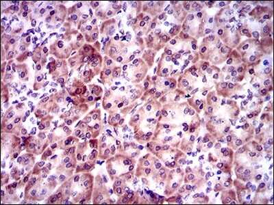 Immunohistochemistry-Paraffin: PSAP Antibody (4D5F4) - BSA Free [NBP2-37422]