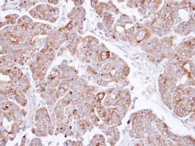 Immunohistochemistry-Paraffin: PSAP Antibody [NBP1-33459]