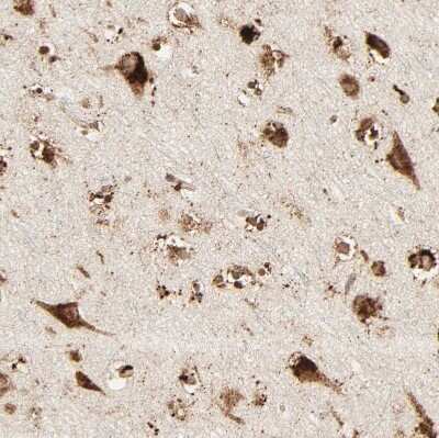 Immunohistochemistry-Paraffin: PSAP Antibody [NBP1-83363]